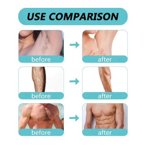 Ecrin Hair Removal Spray (Buy 1 Get 1 FREE)