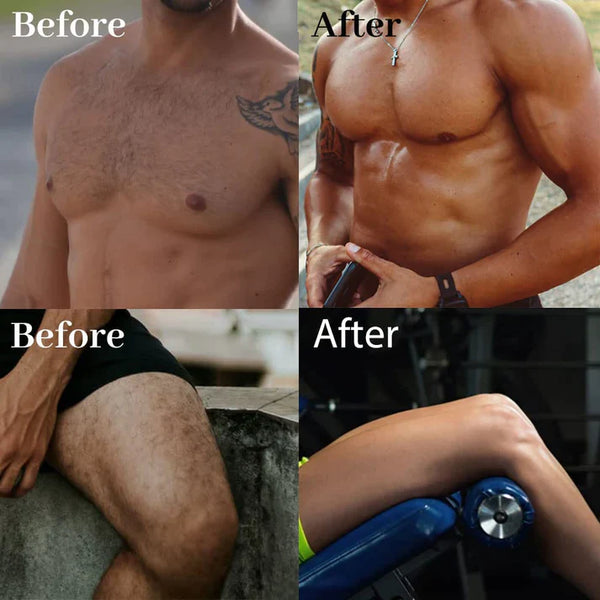 Ecrin Hair Removal Spray (Buy 1 Get 1 FREE)